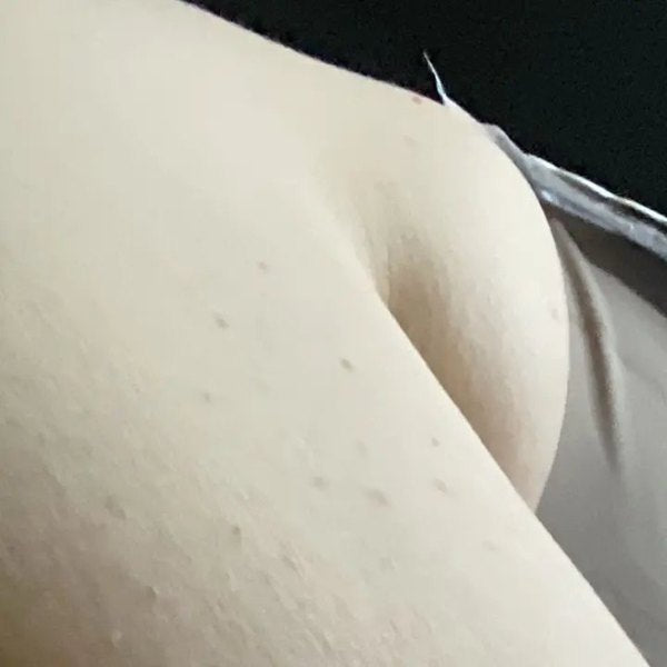 Foto de cliente